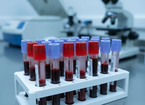 Blood sample tubes in a lab rack